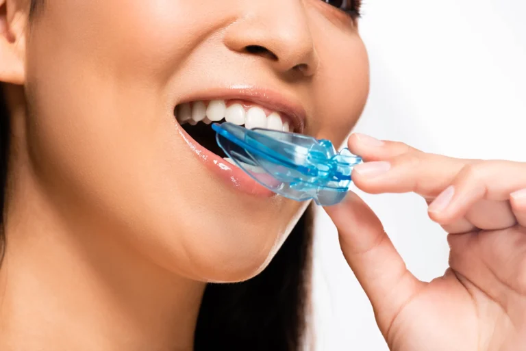 Mouth Guards