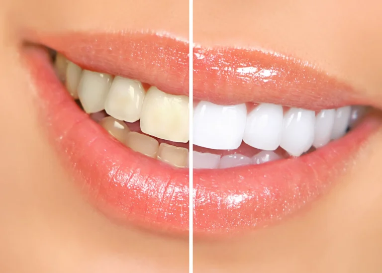 Experience the Benefits of Cosmetic Dentistry for a Beautiful and Confident Smile