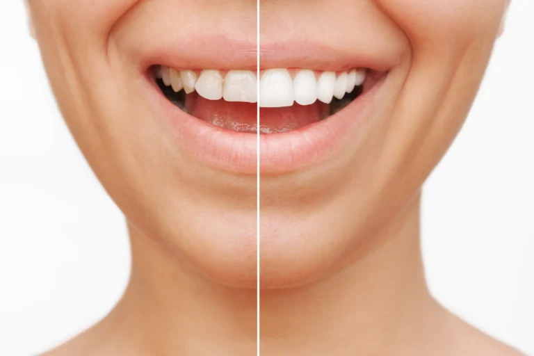 Discover Transformative Cosmetic Dentistry for Your Best Smile